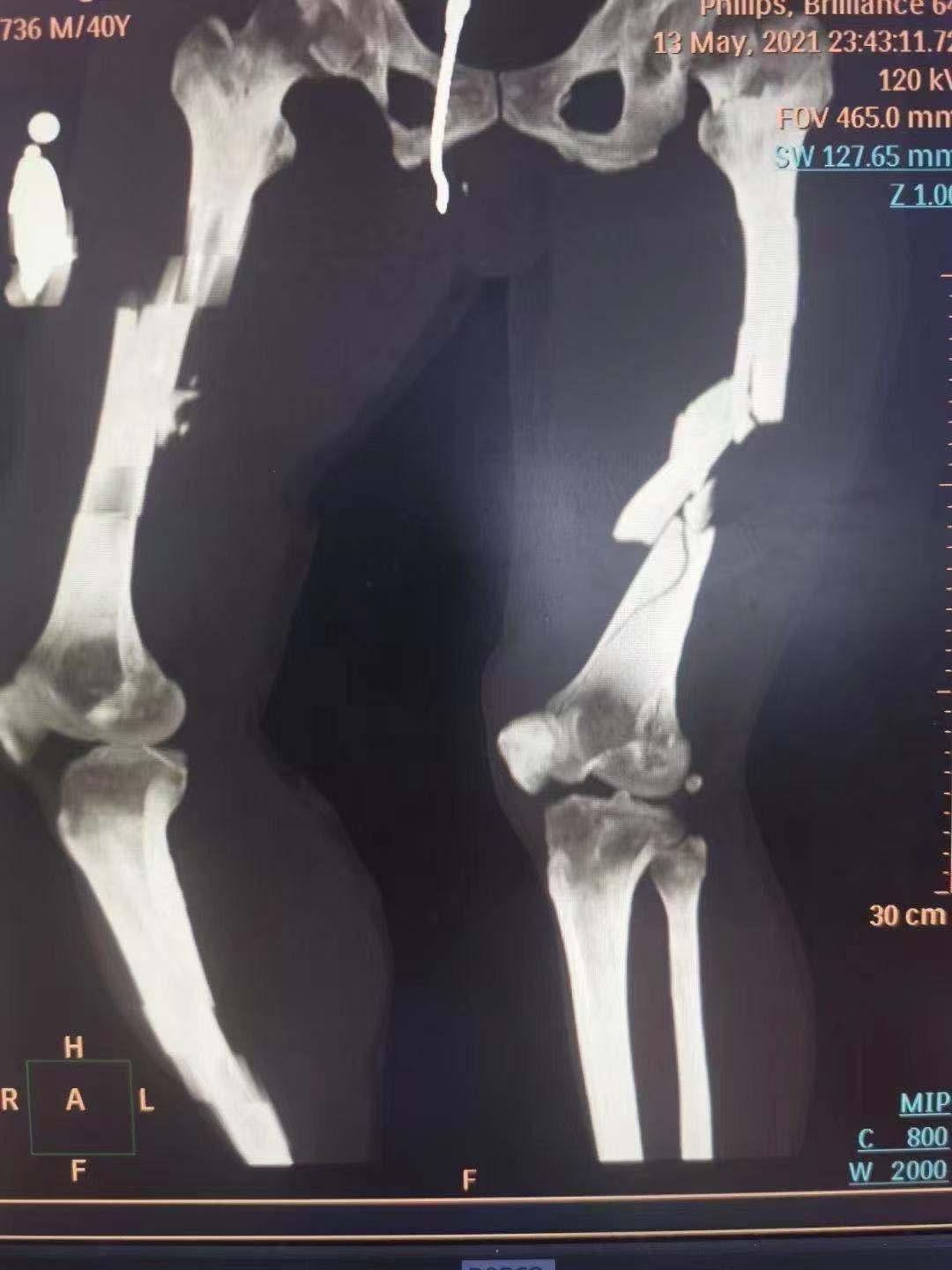 69540b3aabca4e9897ce47f8aa0df6e5.jpg 69540b3aabca4e9897ce47f8aa0df6e5.jpg